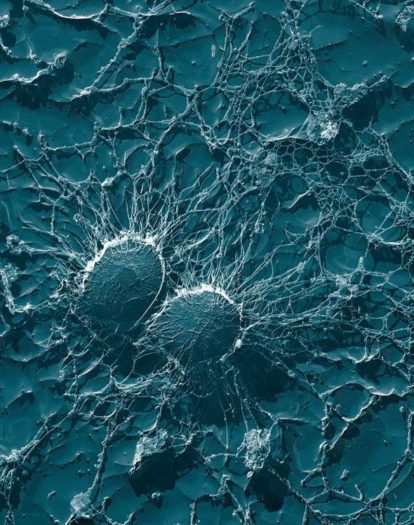 Vibrionen - Ostsee Bakterien